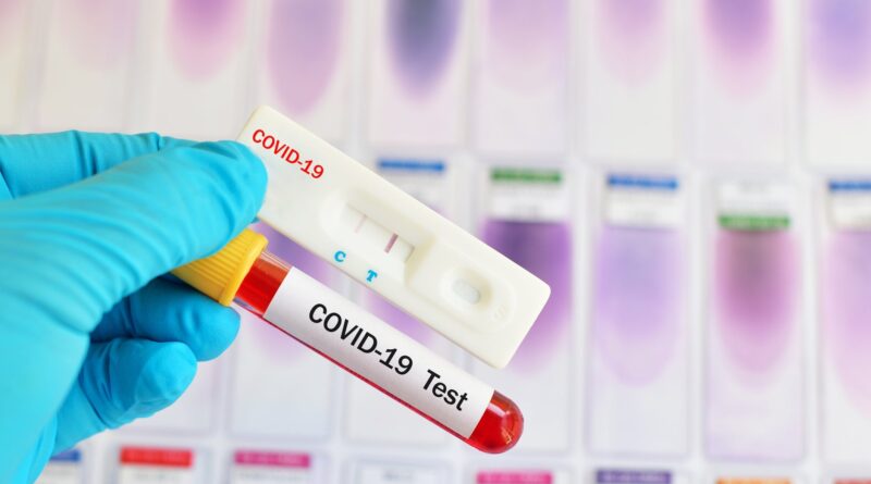 Hogyan működik a már gyógyszertárakban is beszerezhető koronavírus gyorsteszt?